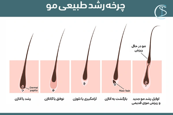 لیزر موهای زائد کرج