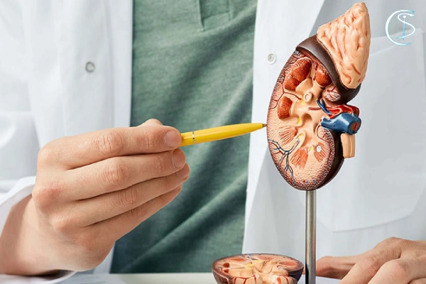 علائم رایج سنگ کلیه