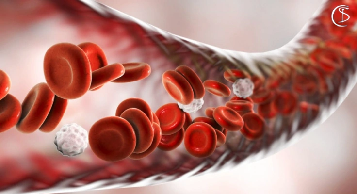 علائم شایع کم خونی چیست؟