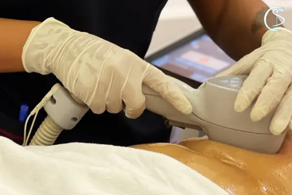 دستگاه لاغری اسکالپشور چیست؟