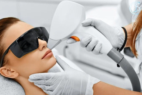 مزیت لیزر مو زائد