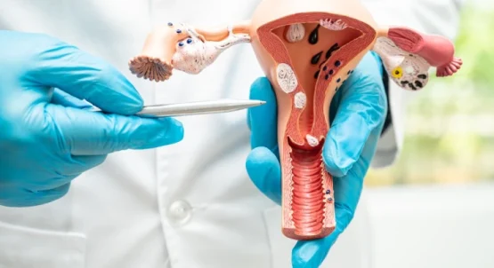 فیبروم رحم چیست و چه درمانی دارد؟