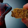 پوکی استخوان چیست و چگونه درمان می شود؟