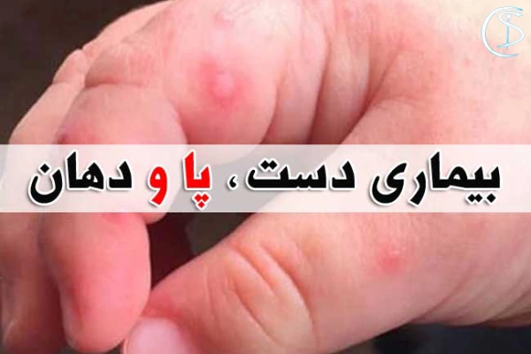 بیماری دست، پا و دهان در کودکان چیست؟