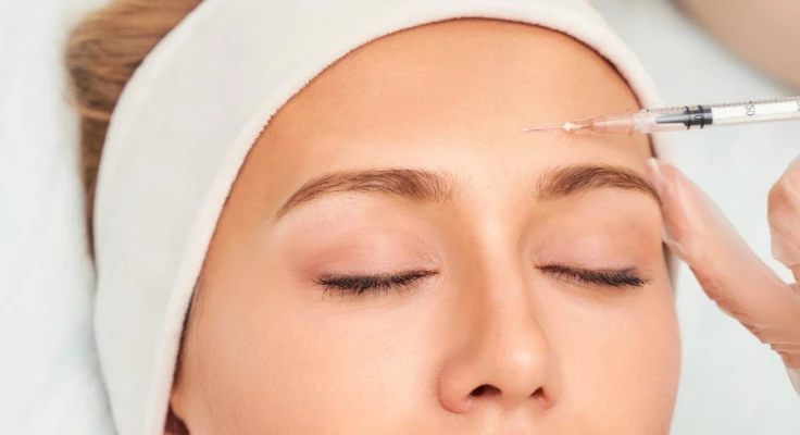 بوتاکس بعد از کاشت ابرو