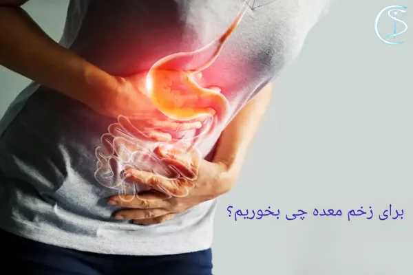 برای زخم معده چی بخوریم؟