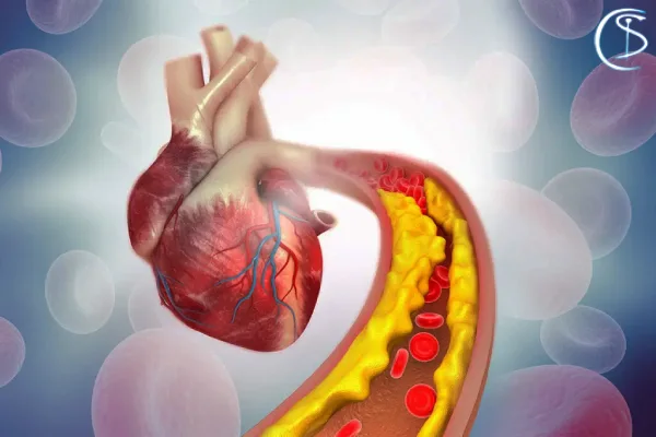 عوارض کلسترول خون