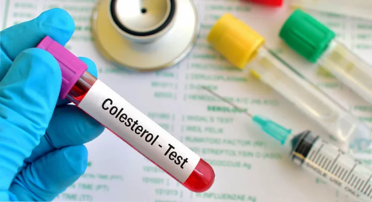 چگونه می توانیم کلسترول خون را کاهش دهیم؟