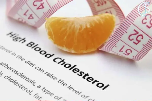 افزایش کلسترول خون