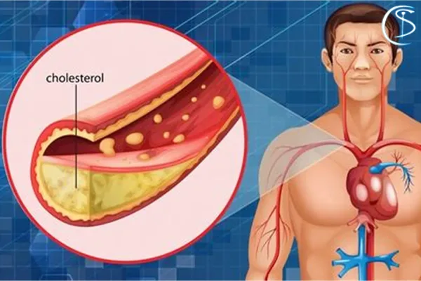 کلسترول خون چیست؟