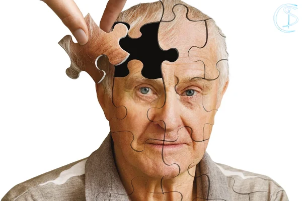 درمان بیماری آلزایمر