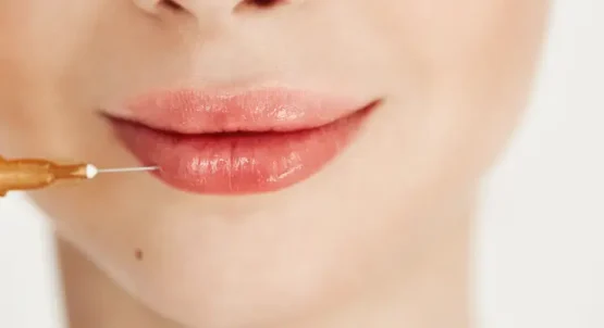 ژل لب چیست؟