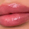 مراقبت‌های بعد از تزریق ژل لب