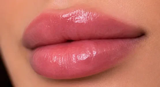 نکات مهم مراقبت‌های بعد از تزریق ژل لب